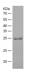    MLC1SA / Recombinant Human MLC1SA