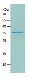 Recombinant Mouse RPLP0