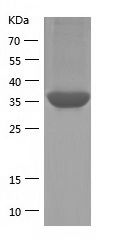    Glutamine Synthetase / Recombinant Human Glutamine Synthetase