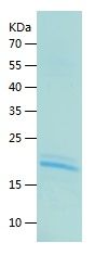    IL-9 / Recombinant Human IL-9