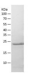    UCHL3 / Recombinant Human UCHL3