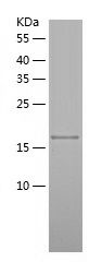    TIMP2 / Recombinant Human TIMP2