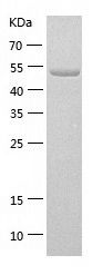    Natriuretic Peptide Receptor A / Recombinant Human Natriuretic Peptide Receptor A