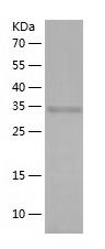 Recombinant Mouse Lactate Dehydrogenase B