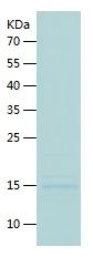    CTLA4 / Recombinant Human CTLA4