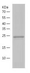    CRISP2 / Recombinant Human CRISP2