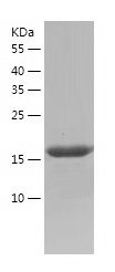    Cytomegalovirus AD169 / Recombinant Human Cytomegalovirus AD169