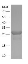    ZNF43 / Recombinant Human ZNF43