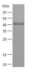    Aspartate Aminotransferase / Recombinant Human Aspartate Aminotransferase