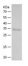    Tryptophan Hydroxylase / Recombinant Human Tryptophan Hydroxylase