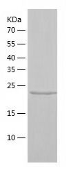    Galectin 3 / Recombinant Human Galectin 3