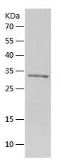    IGFBP3 / Recombinant Human IGFBP3