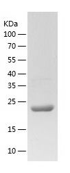    Vinculin / Recombinant Human Vinculin