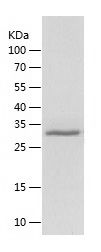 Recombinant Rat Carboxypeptidase B