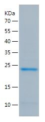    TNNI1 / Recombinant Human TNNI1