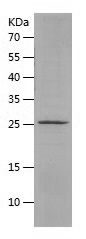    Cardiac Troponin I / Recombinant Human Cardiac Troponin I