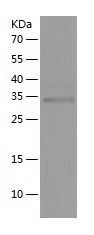    Follistatin / Recombinant Human Follistatin