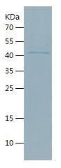    TCN1 / Recombinant Human TCN1