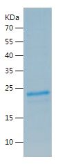    TNF Receptor II / Recombinant Human TNF Receptor II