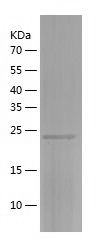    RAB3B / Recombinant Human RAB3B