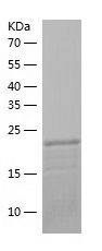    Rab4 / Recombinant Human Rab4