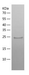    ZNF10 / Recombinant Human ZNF10