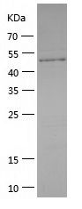 Recombinant Mouse Vitamin D Binding