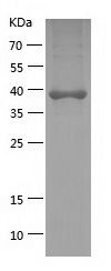    Glycerol 3 Phosphate Dehydrogenase / Recombinant Human Glycerol 3 Phosphate Dehydrogenase