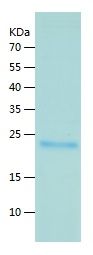    KGF / Recombinant Human KGF