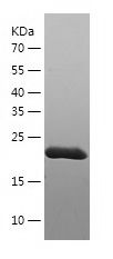    COMT / Recombinant Human COMT