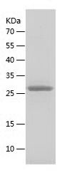    Fibrillarin / Recombinant Human Fibrillarin