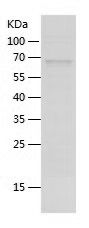    P cadherin / Recombinant Human P cadherin