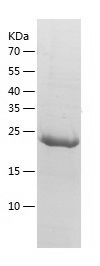    Glutathione Peroxidase 3 / Recombinant Human Glutathione Peroxidase 3