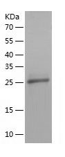    Carbonic Anhydrase 4 / Recombinant Human Carbonic Anhydrase 4