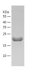    Beta crystallin S / Recombinant Human Beta crystallin S