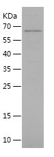    ME2 / Recombinant Human ME2