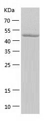    Tryptophanyl tRNA synthetase / Recombinant Human Tryptophanyl tRNA synthetase