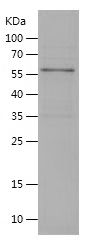 Recombinant Mouse Carboxylesterase 1C