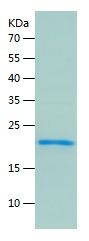    IL-32 / Recombinant Human IL-32