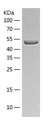    Alanine Transaminase / Recombinant Human Alanine Transaminase