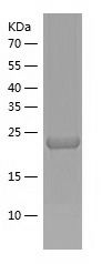    IGFBP6 / Recombinant Human IGFBP6