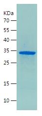    IGFBP5 / Recombinant Human IGFBP5