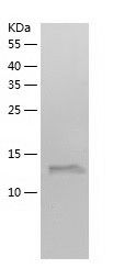    Acid phosphatase / Recombinant Human Acid phosphatase