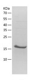    MYL9 / Recombinant Human MYL9