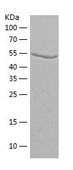 Recombinant Rat Alanine Transaminase