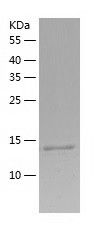    BRD2 / Recombinant Human BRD2