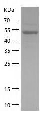    BRD2 / Recombinant Human BRD2