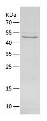    ATP5A / Recombinant Human ATP5A