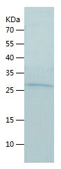    Proteasome 20S alpha 2 / Recombinant Human Proteasome 20S alpha 2