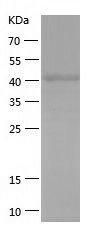    PAX6 / Recombinant Human PAX6